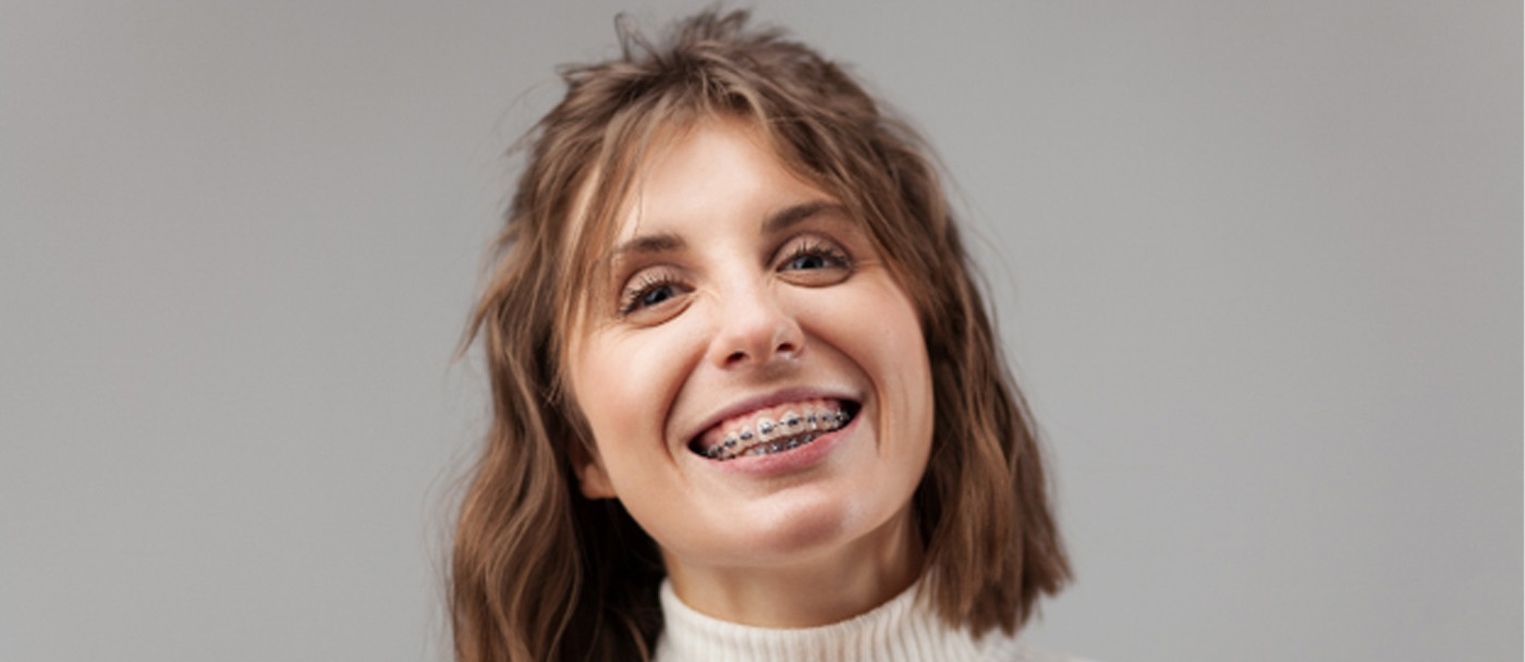 Woman smiling with braces