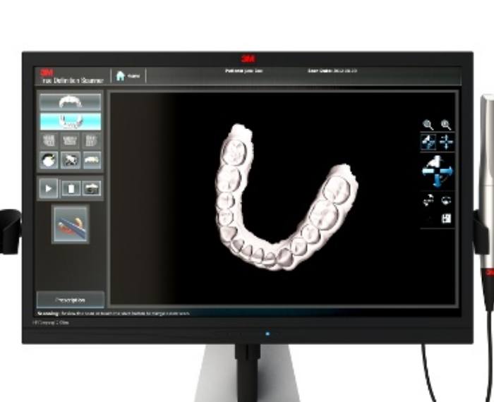 Screen showing digital model of a row of teeth