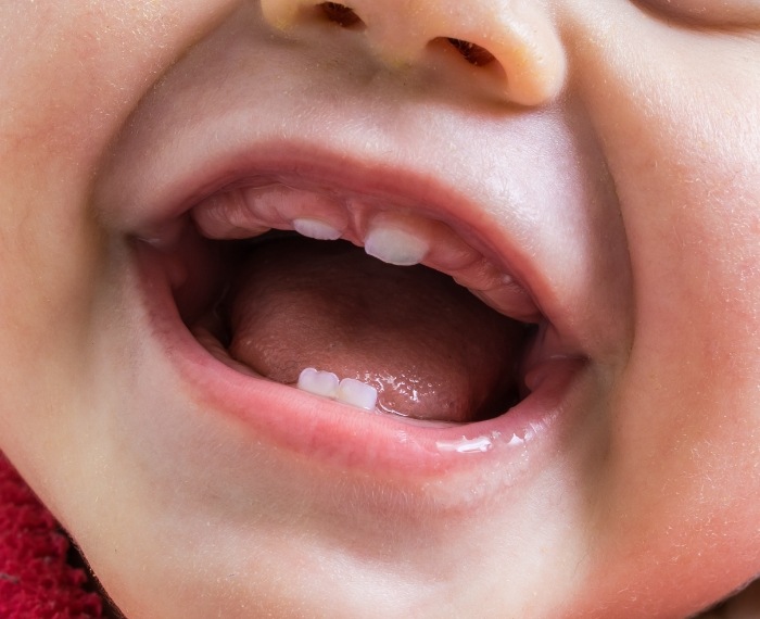 Close up of smiling baby with only a few teeth