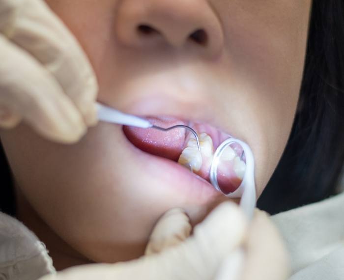 Dentist examining a childs teeth